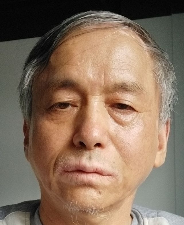 9杰米的第一张照片--成都残疾人相亲网